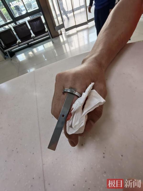  一枚戒指差点废掉他的手指！消防和医生联手"拆弹"背后的惊险24小时 健康养生